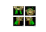 do radiology image and medical imaging  annotation